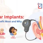 Cochlear Implants in Bangalore – Advanced Hearing Solutions | Trust-in Hospital