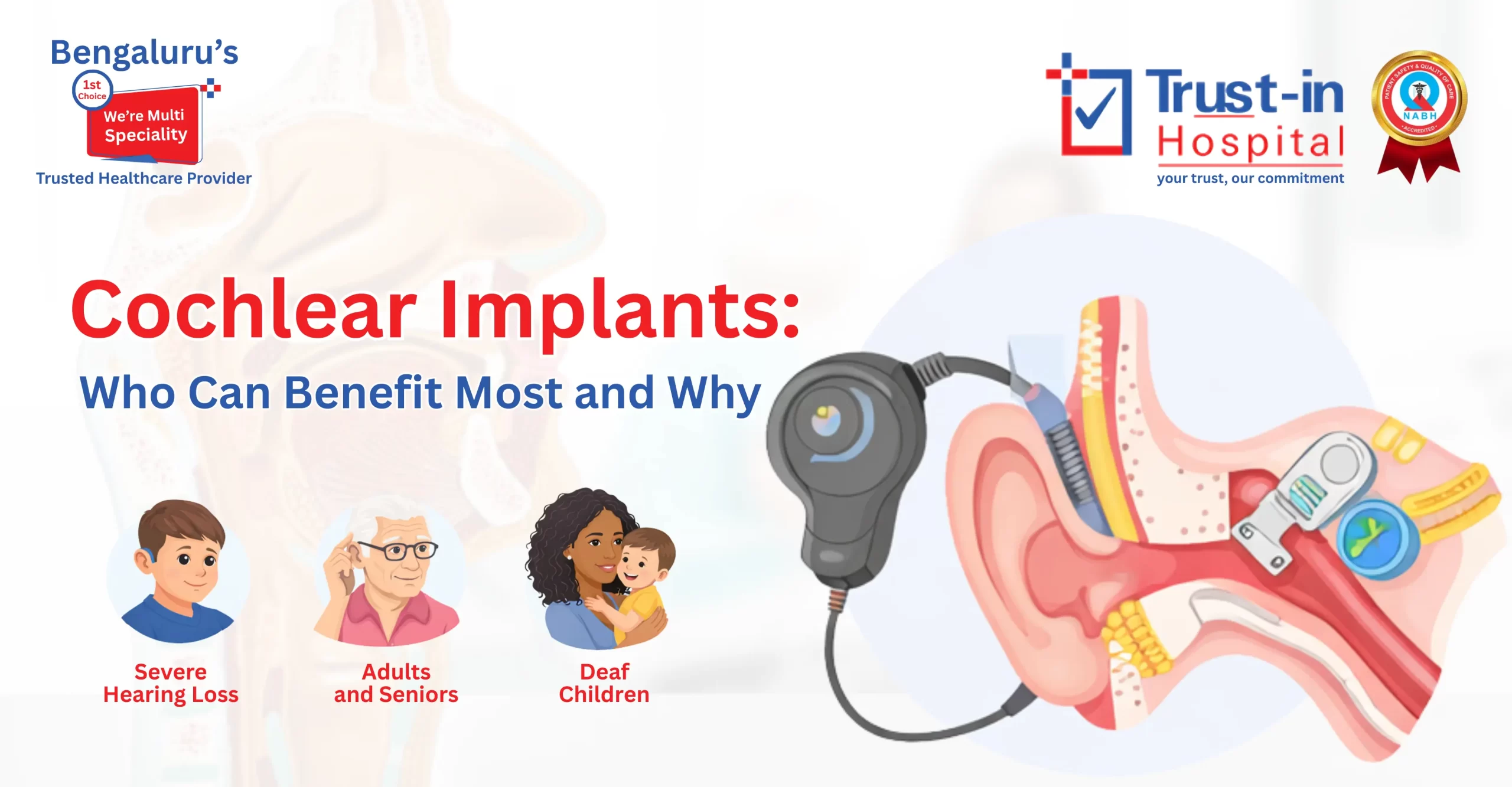 Cochlear Implants Breakthrough: Modern Hearing Technology and Its Long-Term Impact
