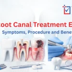 Root Canal Treatment | Trust-In Hospital