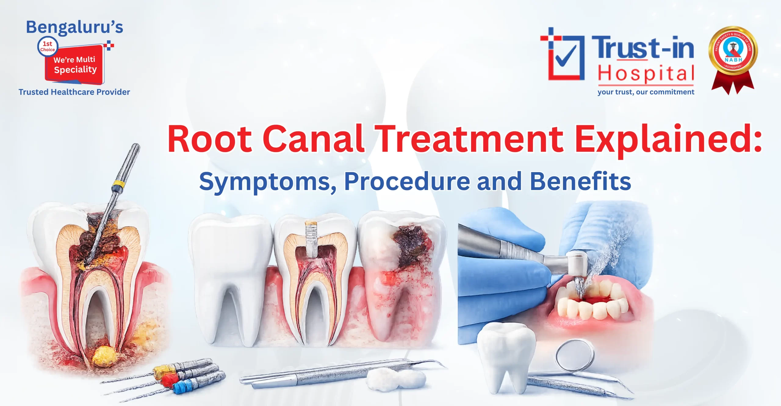 Root Canal Treatment Explained: A Practical Guide to Symptoms & Benefits